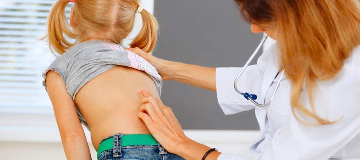 Adolescent Idiopathic Scoliosis