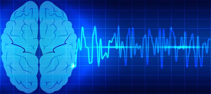 EEG Testing