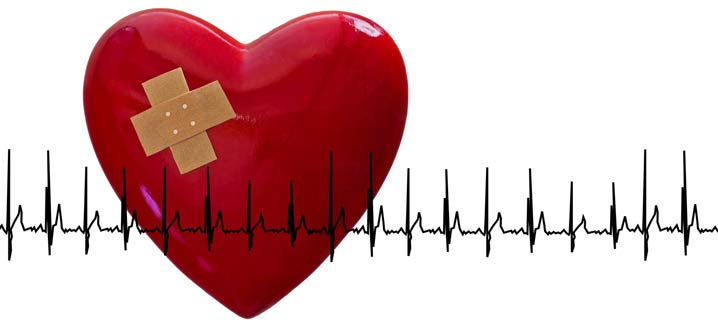 Congenital Heart Defects