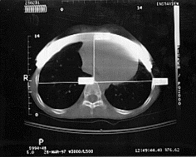 PostoperativeXray